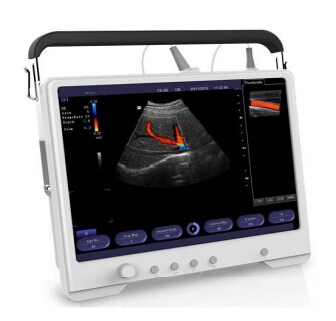 multi-frequency ultrasound scanner & ultrasonic ultrasound palmtop vet ultrasound scanner