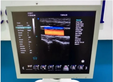 Trolley Color 3D/4D Doppler Human Pregnancy Ultrasound Machine