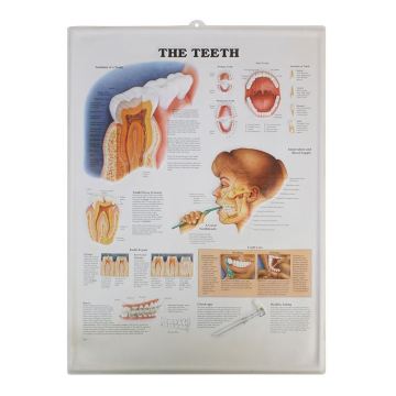 3D Medical Anatomical Wall Chart Teeth: Durable, Lightweight, Recyclable Plastic Display