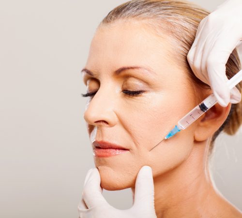 Dermal Fillers for the Lower Face