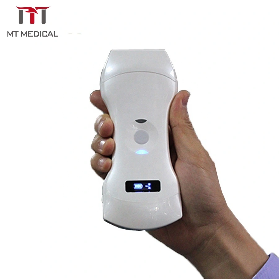 Medical Diagnostic Equipment Wireless Handheld Linear/Convex Array Probe Ultrasound Scanner