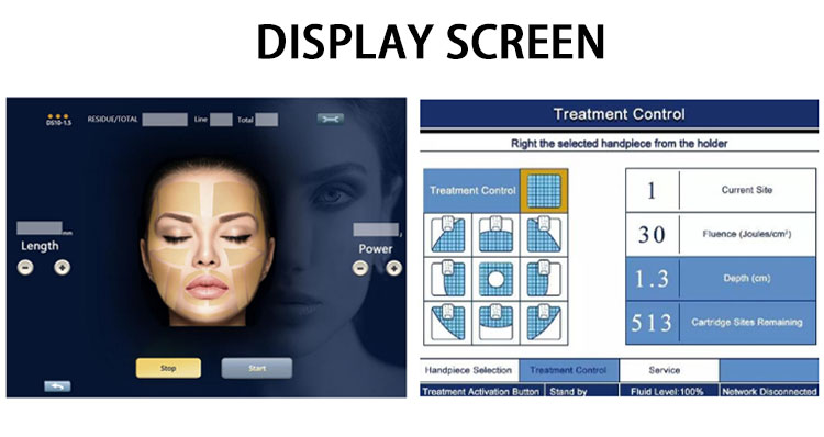 Liposonix Hifu Device