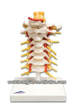 Cervical Vertebral Column with Neck Artery, Occipital, Herniated Disc and Nerves