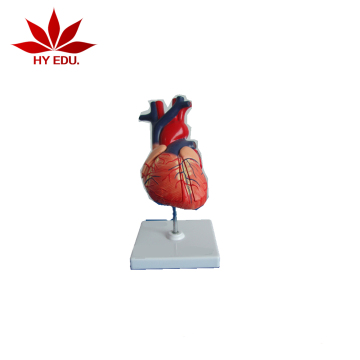 Best Selling Human Enlarged Heart Model for Medical Teaching