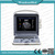 Wondcon medical portable ultrasound scanner