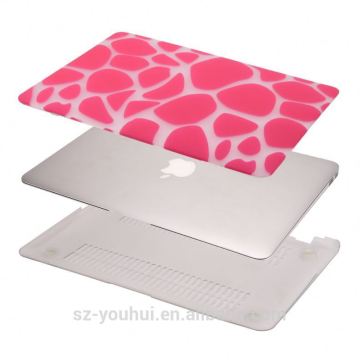 New arrival accesories for Macbook