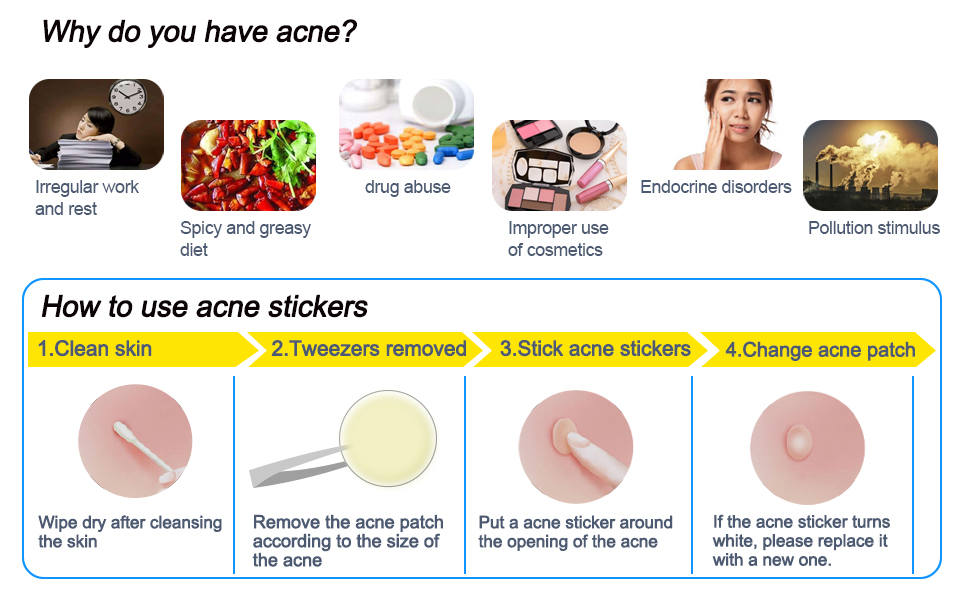 Akne-Pickel-Patch absorbierender Hydrokolloid-Spot-Behandlung Schnelle Heilung, Fleckenabdeckung