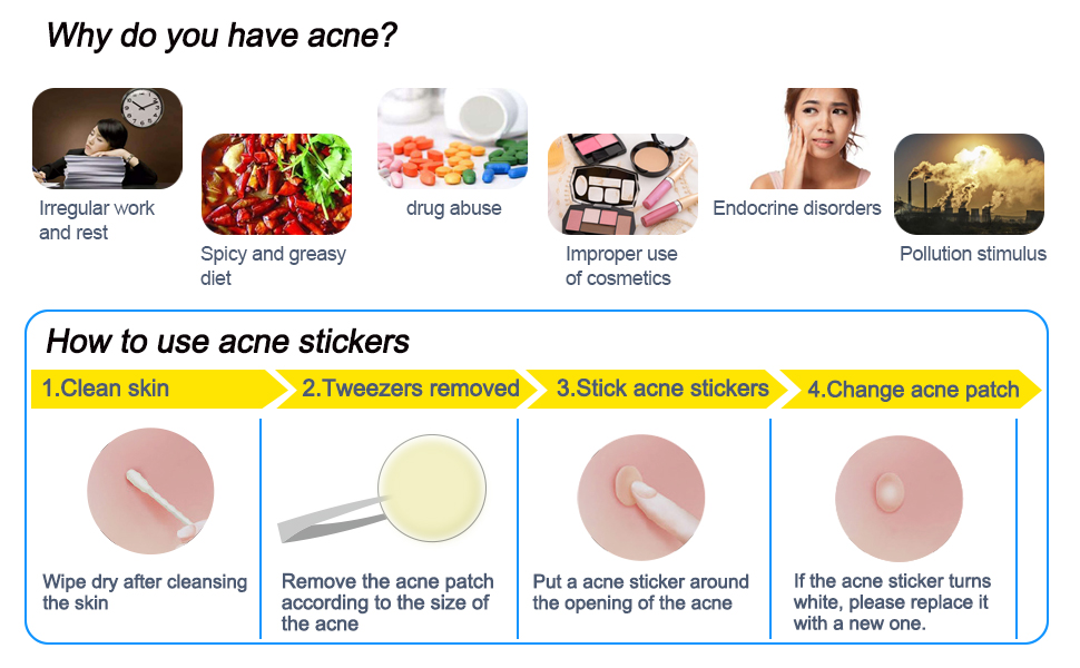 Uso diário e noturno Cura de acne adesivos à prova d'água Tratamento de ponto de espinha