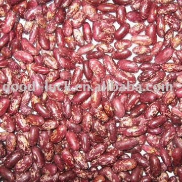 Purple Speckled Kidney Bean/Red Speckled Kidney Bean