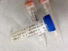 Anti - HBsAg Mouse Monoclonal Antibodies Mab High Sensitivi