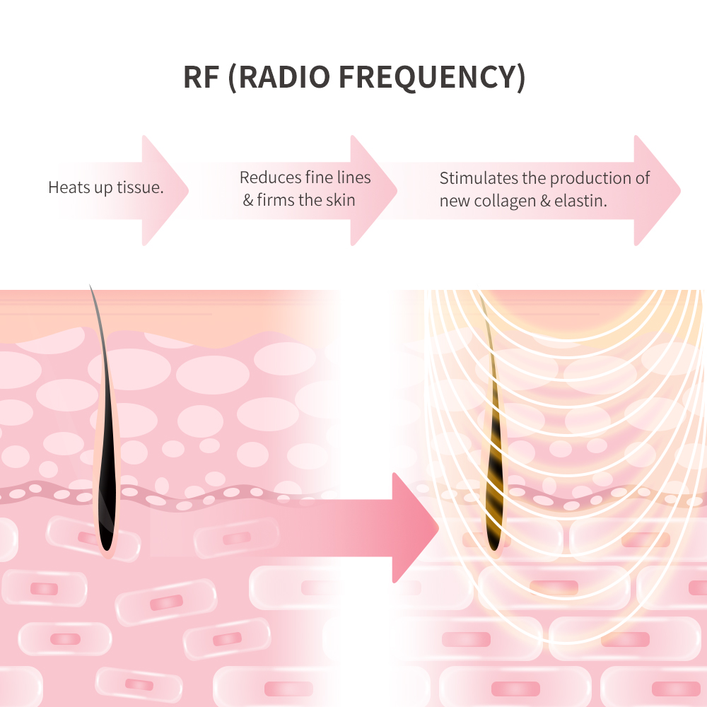 Principle of Radio Frequency 