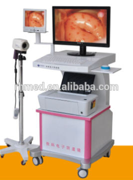 High-technology Full Digital Sony Colposcope for Sale