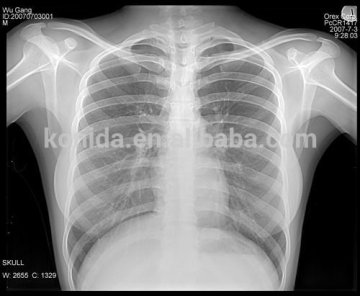 sensitive medical xray film