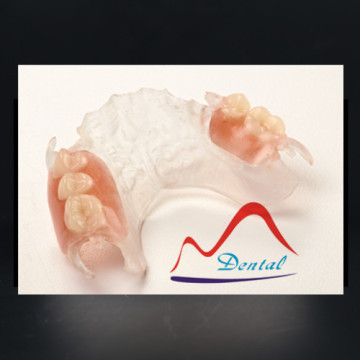 Dental ClearFrame® partial denture