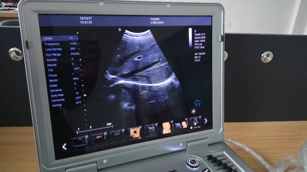 Portable Handheld Animal Pregnancy Veterinary Digital Ultrasound Scanner