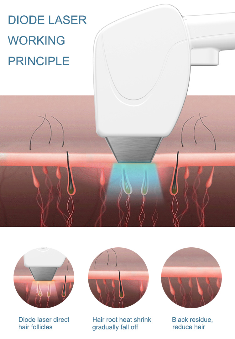 808 Hair Removal Machine