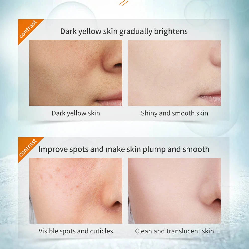 Acne Treatment Pure Lemongrass Facial Cleanser Firming Nourishing Health Skin Black Facing Washings