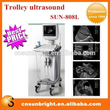 trolley ultrasound scanner/trolley mobile ultrasound machine