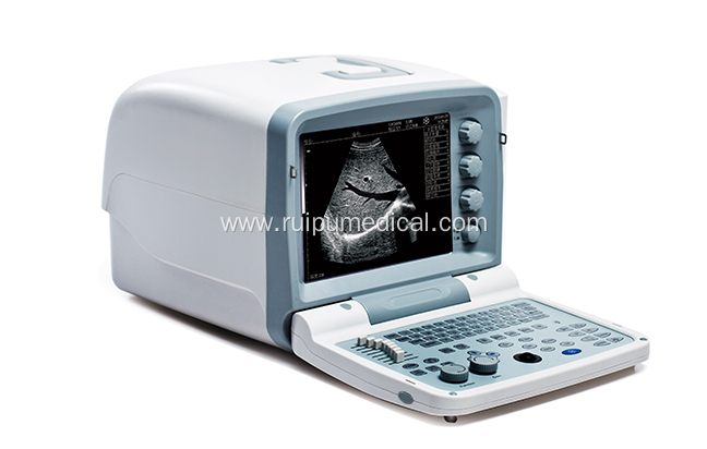 Full Digital B Mode Ultrasonic Diagnostic Instruments