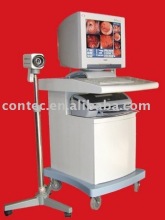 High resolution images electronic colposcope,digital colposcope,vagina colposcope