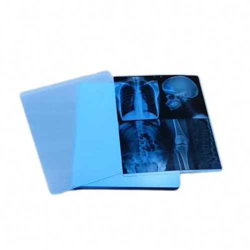 Silica Powder-Blue Inkjet Film For Medical Image Output