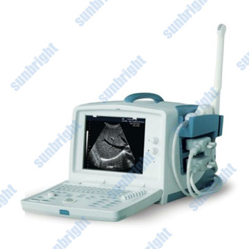 Pc-based ultrasound scanner