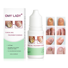 OEM Private Label Anti-Fungal Nail Strengthener Treatment