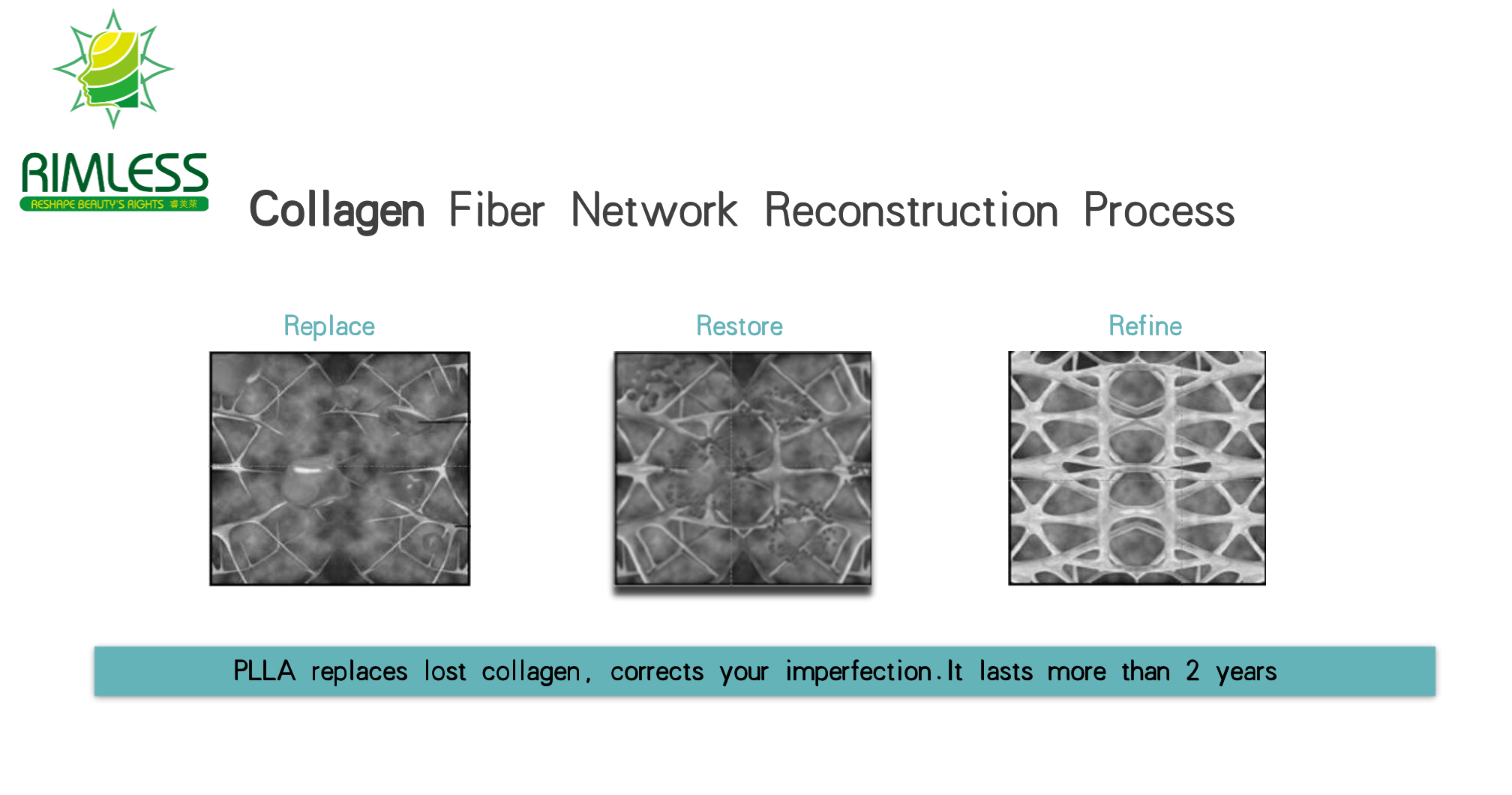 filler collagen fiber network reconstruction process