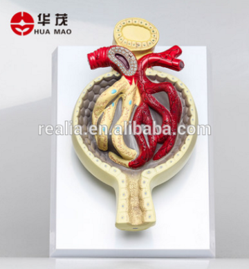 HM-BD-138B PVC kidney Nephron anatomical model Nephron Anatomy model