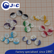 River shell button, mop buttons, shell button, R buttons, oil button, shirt button