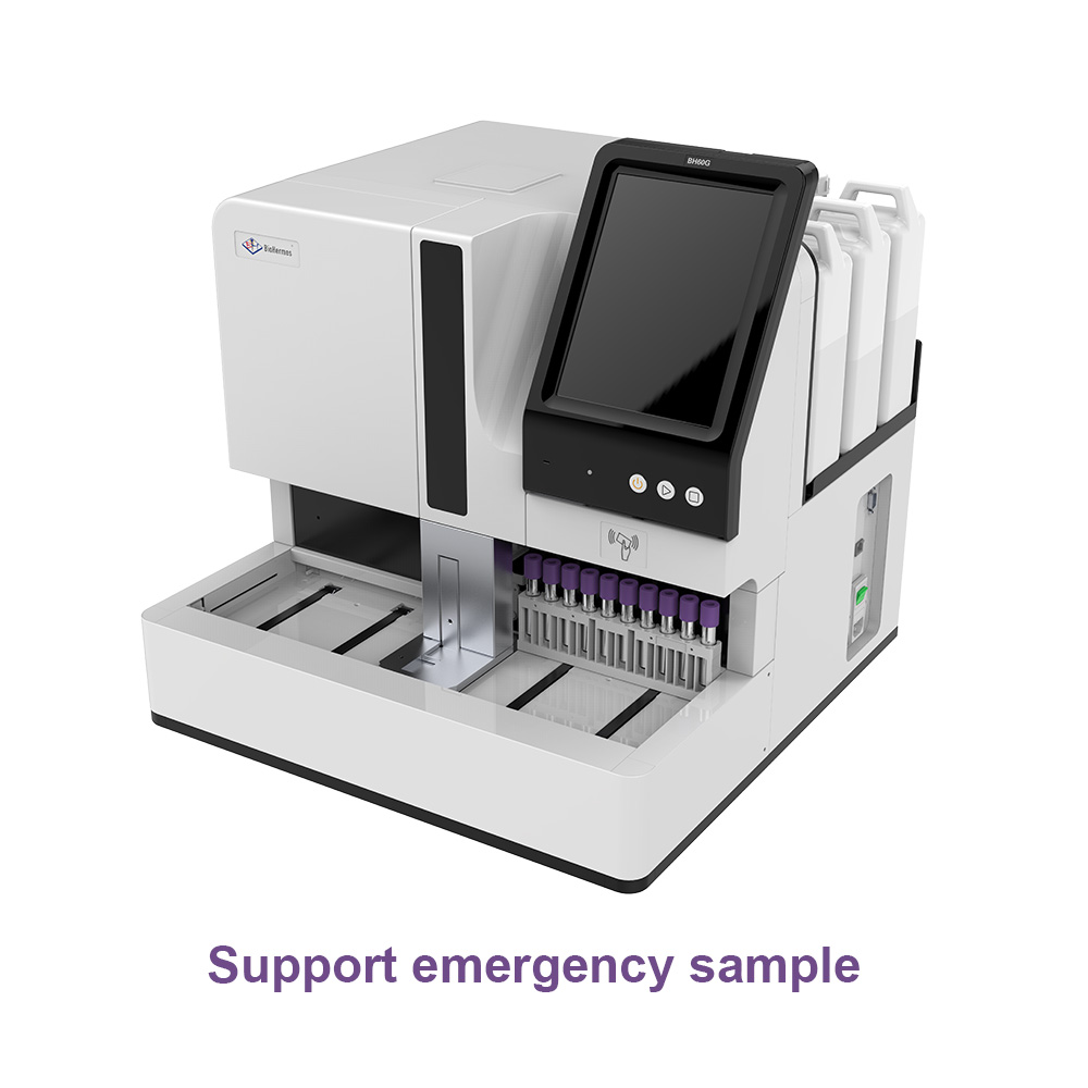 Instrumen Hemoglobin Glikasi HPLC Laboratorium