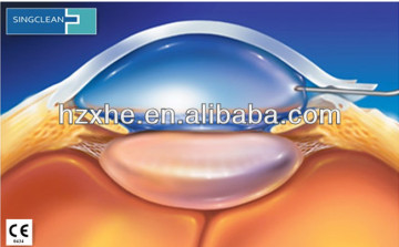 Sodium Hyaluronate Ophthalmic Solution