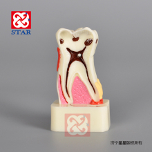 Single Tooth Anatomy Pathology Dental Model - 4 Times Magnification