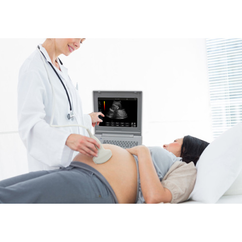 Sonostar SS-6B Ultrasound Machine