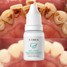 Professional Easy White Teeth Whitening Essence - Liquid for Teeth Whitening