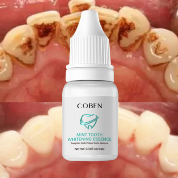 Professional Easy White Teeth Whitening Essence - Liquid for Teeth Whitening