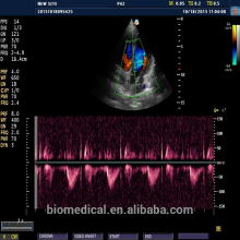 Laptop Portable 3D Color Doppler UltrasoundScanner Ultrasonic Machine