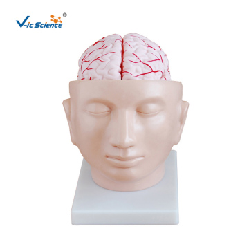 Brain With Arteries On Head