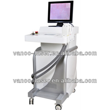 beauty vertical ipl equipments