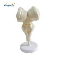 Brain stem amplification model