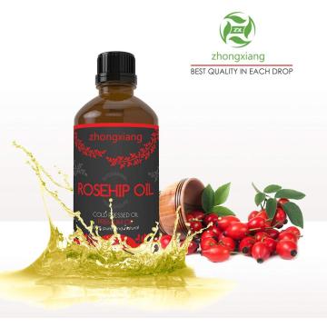 Óleo orgânico do Rosehip para o OEM da aromaterapia da massagem dado boas-vindas