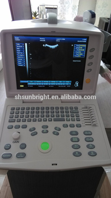 Laptop portable ultrasound scanner/laptop ultrasound machine