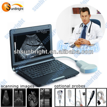 B&W portable/laptop ultrasound