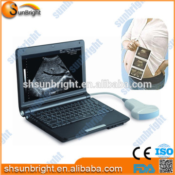 Portable/Handheld medical equipment ultrasound machine