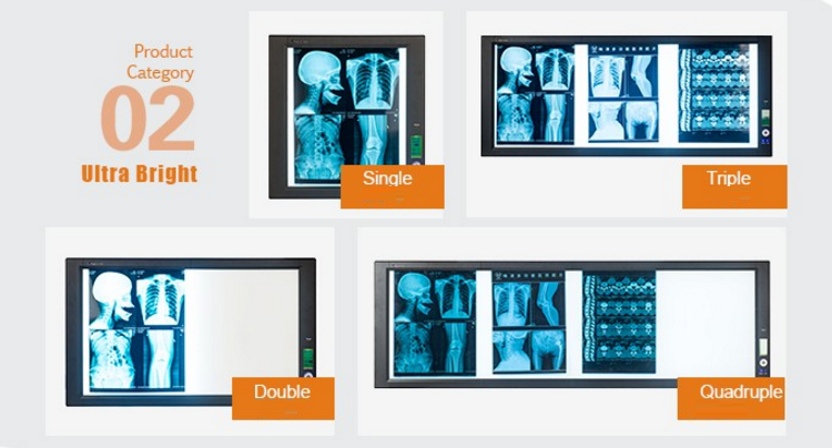 Wholesale Hospital Use Led X-Ray Film Viewer