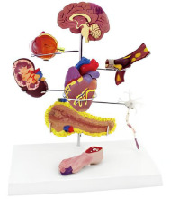 Diabetes model