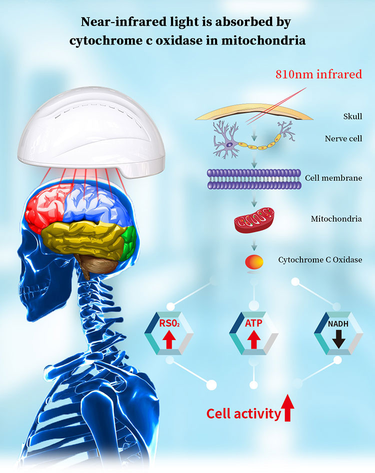 Máquina de terapia cerebral de 810 nm Dispositivo terapéutico neuronico