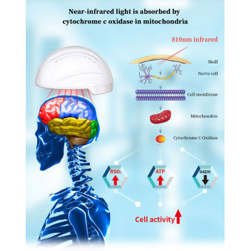 810nm Hirntherapiemaschine Neuronic Therapeutic Device