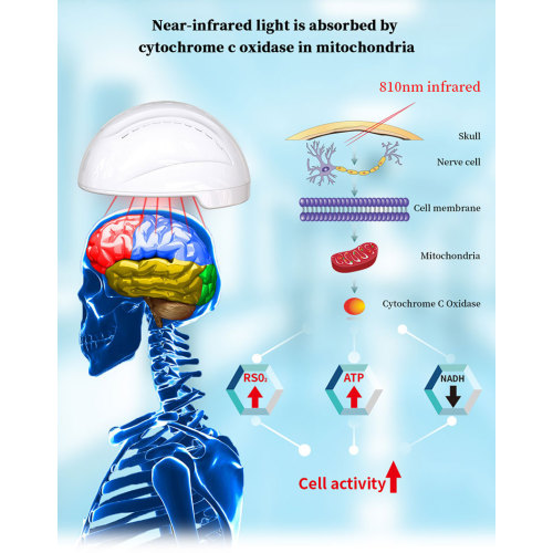 810nm Terapia cerebral Máquina neurônica Terapêutica Dispositivo