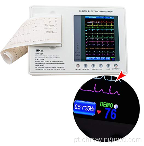 Preço da máquina de ECG digital para hospital
